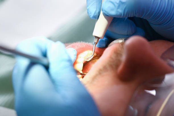 Best Broken Tooth Emergency  in Cherry Hill Mall, NJ