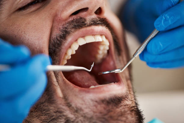 Best Dentist for Tooth Abscess  in Cherry Hill Mall, NJ