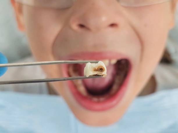 Best Emergency Pediatric Dentist  in Cherry Hill Mall, NJ